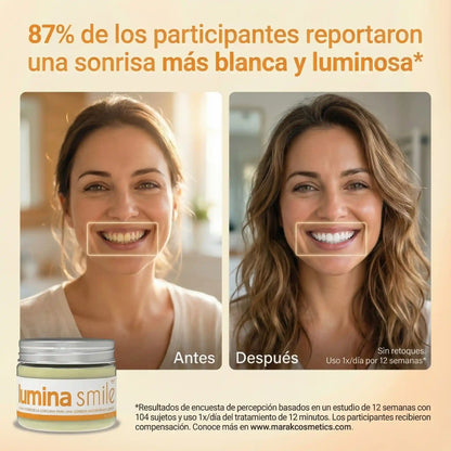Lumina Smile: Blanquea sin dolor - especial para dientes sensibles