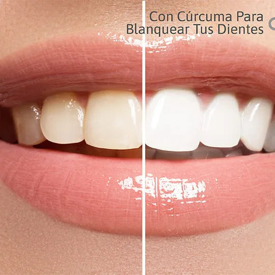 Lumina Smile: Blanquea sin dolor - especial para dientes sensibles