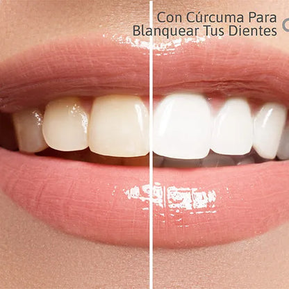 Lumina Smile: Blanquea sin dolor - especial para dientes sensibles