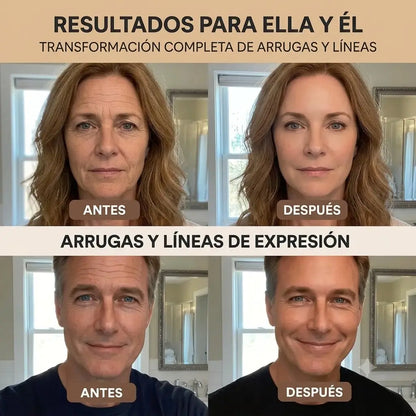BÁLSAMO ORGÁNICO DE SEBO DE RES Y MIEL - ELIMINA ESTRIAS, ACNE Y LINEAS DE EXPRESION EN SEGUNDOS